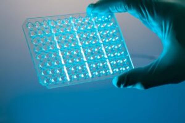 RT-qPCR can be high throughput with 96-well plates.