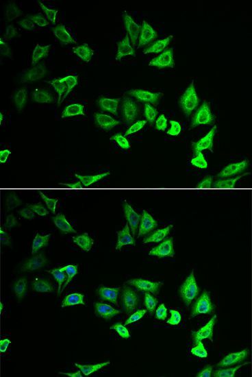 Immunofluorescence - MYOZ2 antibody (144-06468)