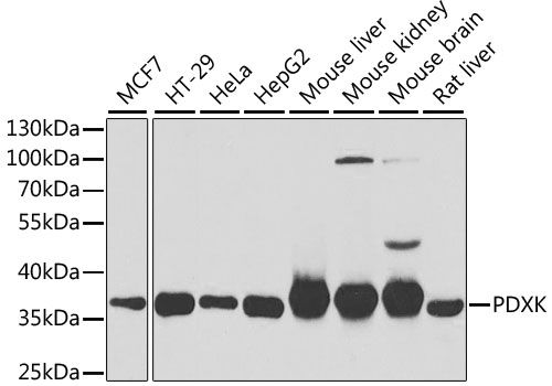 Western blot - PDXK Polyclonal Antibody (144-06687)