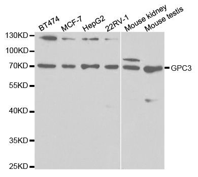 Western blot - GPC3 antibody (144-01946)
