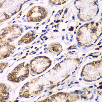 Immunohistochemistry - RPN1 antibody (144-600827)