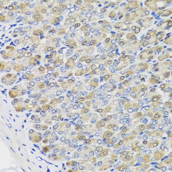 Immunohistochemistry - CBR3 antibody (144-07545)