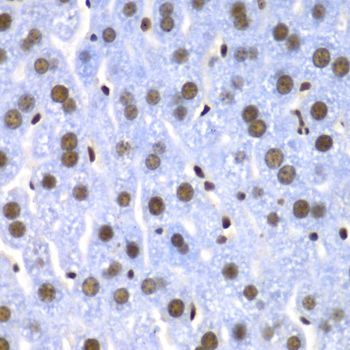 Immunohistochemistry - SF3B2 Polyclonal Antibody (144-05875)