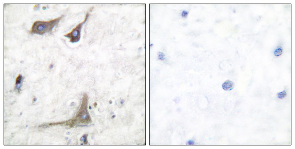 IHC