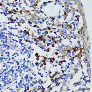 Immunohistochemistry - USO1 Polyclonal Antibody (144-02796)