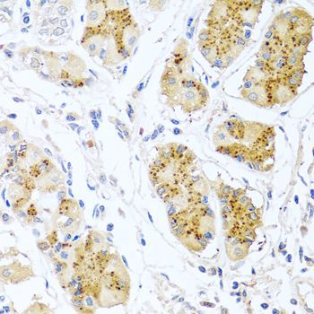 Immunohistochemistry - EDN1 Polyclonal Antibody (144-00686)