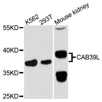 Western blot - CAB39L antibody (144-61408)