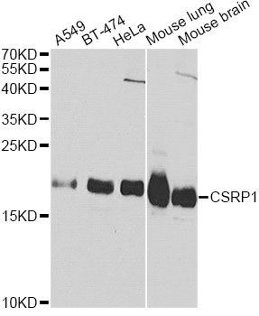 Western blot - CSRP1 Polyclonal Antibody (144-01071)
