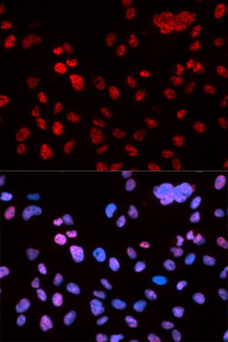 Immunofluorescence - Phospho-p53-S9 pAb (144-50085)