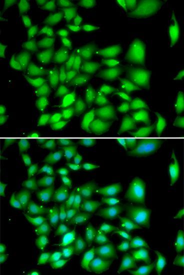 Immunofluorescence - TREX1 Polyclonal Antibody (144-06778)