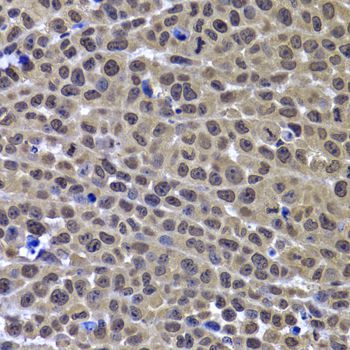 Immunohistochemistry - GPS1 Polyclonal Antibody (144-06917)
