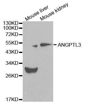 Western blot - ANGPTL3 Polyclonal Antibody (144-00689)