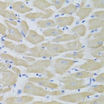 Immunohistochemistry - KRT5 Antibody (144-02662)