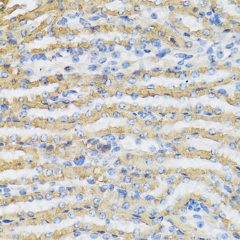 Immunohistochemistry - C4BPB antibody (144-06362)