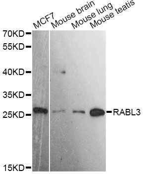 Western blot - RABL3 antibody (144-60638)