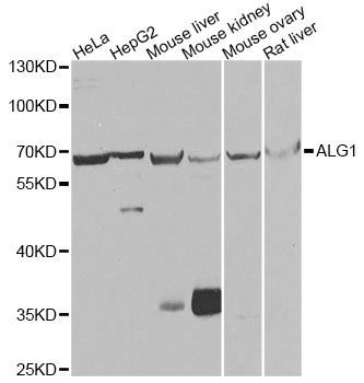 Western blot - ALG1 antibody (144-07818)