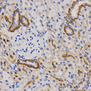 Immunohistochemistry - PIBF1 Antibody (144-03072)