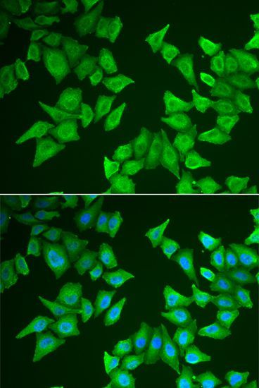 Immunofluorescence - ALAS2 antibody (144-06522)