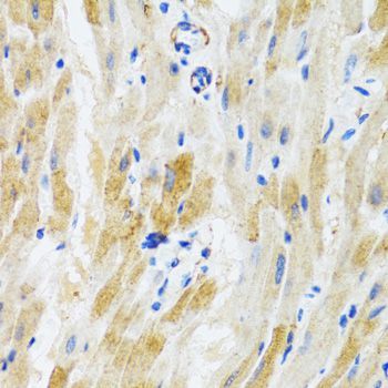 Immunohistochemistry - PHPT1 antibody (144-01127)