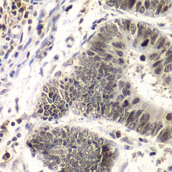 Immunohistochemistry - [KO Validated] SMARCA4 Polyclonal Antibody (144-00887)