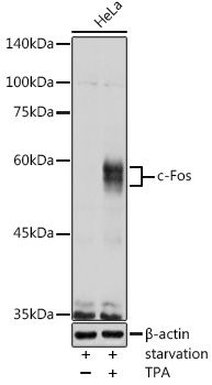 Western blot - FOS Polyclonal Antibody (144-00236)