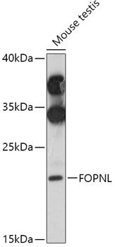 Western blot