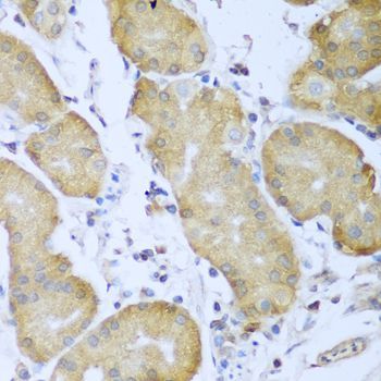 Immunohistochemistry - IGF2BP3 Polyclonal Antibody (144-02750)