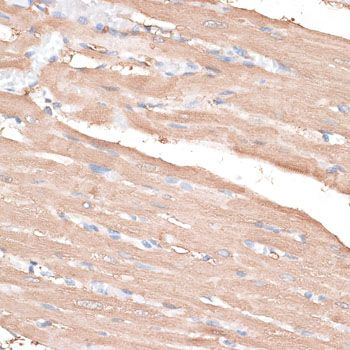 Immunohistochemistry - KIF14 Polyclonal Antibody (144-10275)