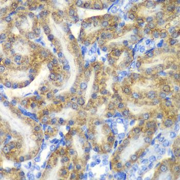 Immunohistochemistry - FAH antibody (144-60359)