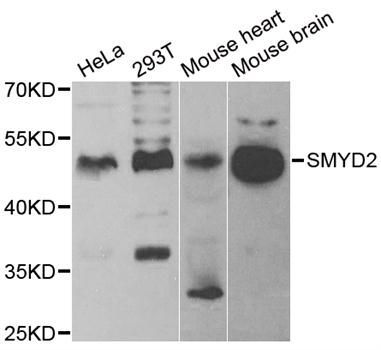 Western blot - SMYD2 Polyclonal Antibody (144-06474)