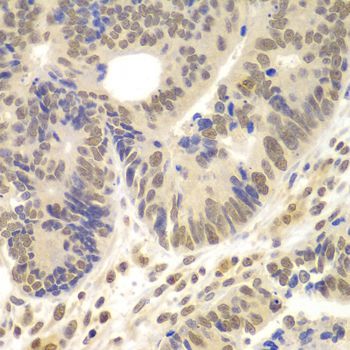 Immunohistochemistry - LHX4 antibody (144-08072)