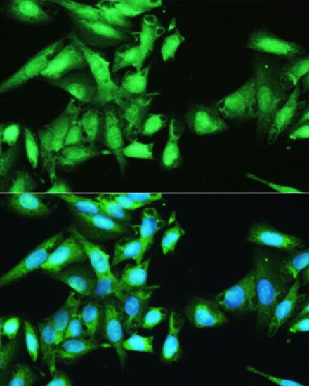 Immunofluorescence - STAT1 Polyclonal Antibody (144-012075)