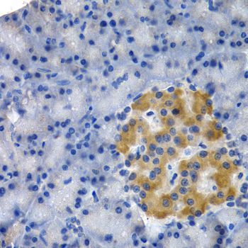 Immunohistochemistry - HSPB8 antibody (144-02514)