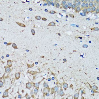 Immunohistochemistry - FDFT1 antibody (144-06229)