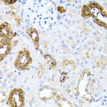 Immunohistochemistry - SHH antibody (144-07726)