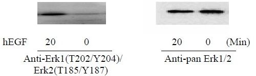 ERK1 (T202/Y204) and ERK2 (T185/Y187) - Western Blot