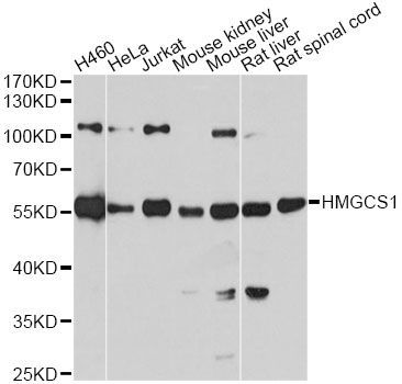 Western blot - HMGCS1 antibody (144-03916)