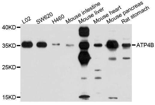Western blot - ATP4B Polyclonal Antibody (144-600496)