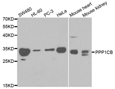Western blot - PPP1CB antibody (144-01088)