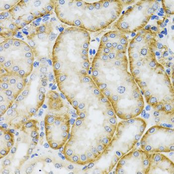 Immunohistochemistry - ARFGAP1 Polyclonal Antibody (144-07118)
