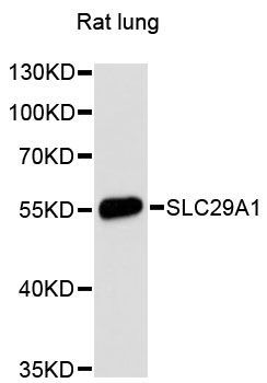 Western blot - SLC29A1 Polyclonal Antibody (144-60238)