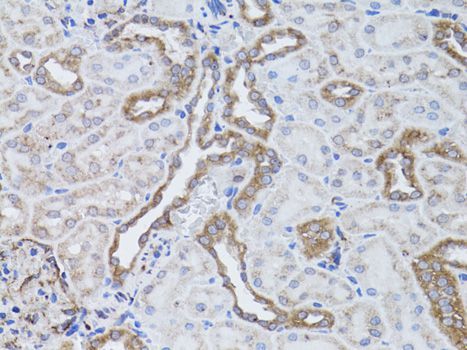 Immunohistochemistry - ITGAV antibody (144-02091)