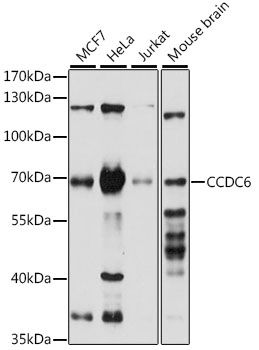 Western blot