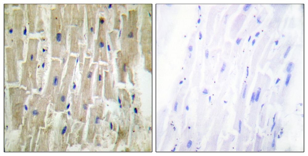 IHC