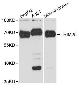 Western blot - TRIM25 Polyclonal Antibody (144-12938)