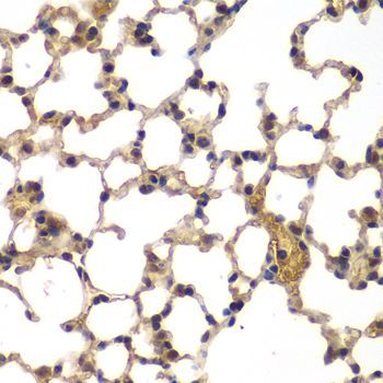 Immunohistochemistry - ASPSCR1 Polyclonal Antibody (144-07481)