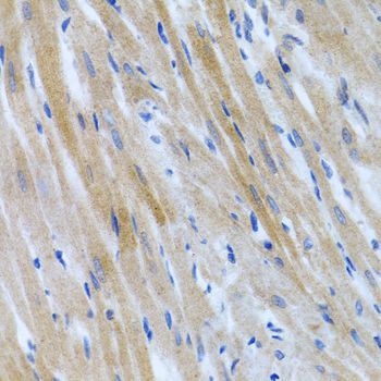Immunohistochemistry - BMP3 antibody (144-06877)