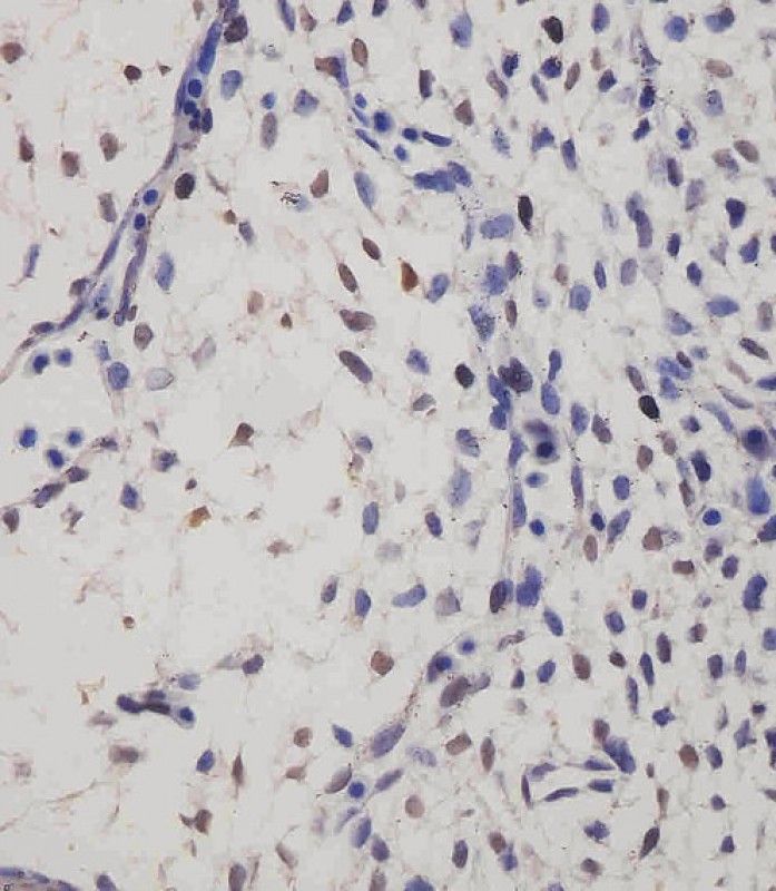 IHC-P