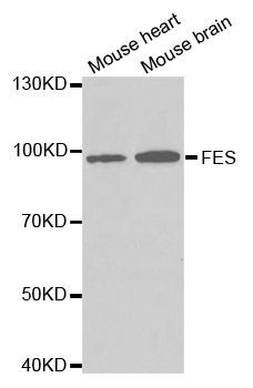 Western blot - FES antibody (144-02578)