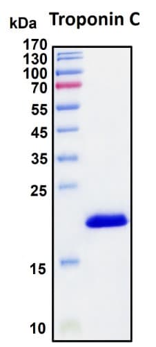 SDS-PAGE Image